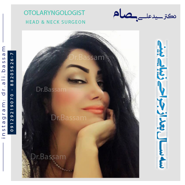 سلفی بیمار از نتیجه جراحی بینی دکتر بصام