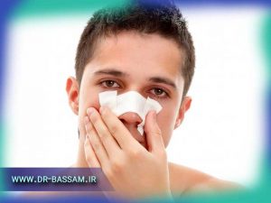 هزینه عمل شکستگی بینی چقدره