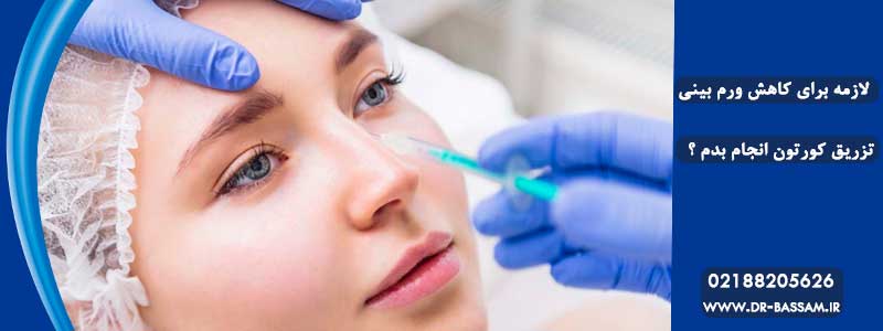 تزریق کورتون به بینی بعد از عمل جراحی بینی