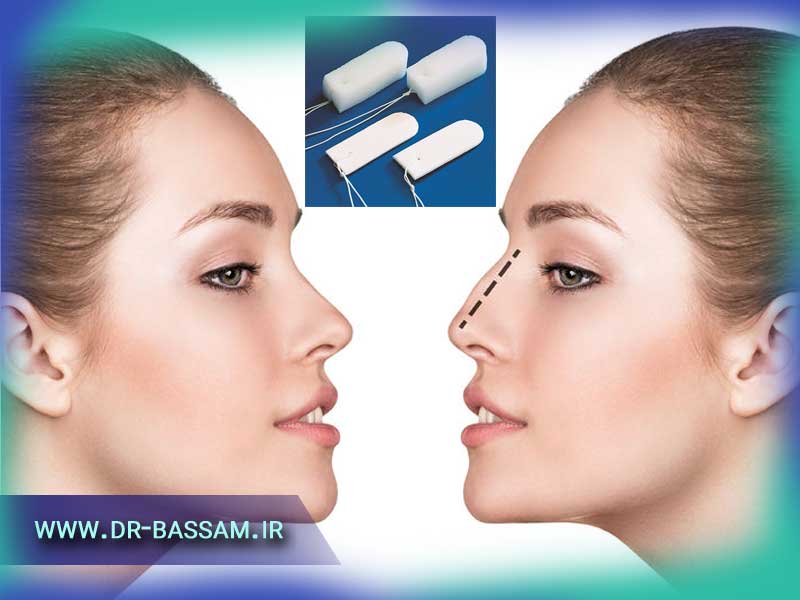 تامپون عمل بینی