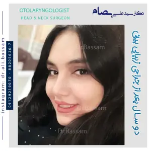 تغییر چهره عمل بینی