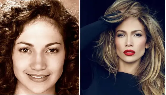 چهره بازیگران بعد از عمل جنیفر لوپز