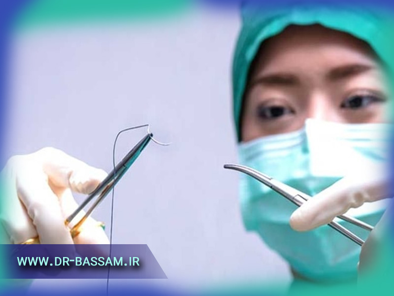 اسکار یا جای زخم بعد از عمل جراحی زیبایی بینی از جمله عارضه هایی است که طبیعی محسوب می شود. اما می توان با اقداماتی به کاهش اثرات آن کمک کرد.