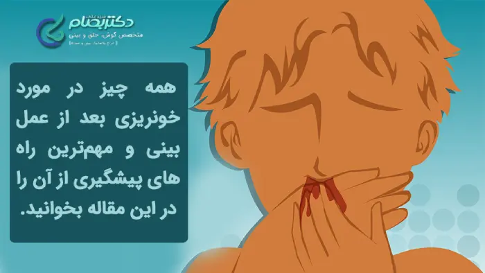 خونریزی بعد عمل بینی