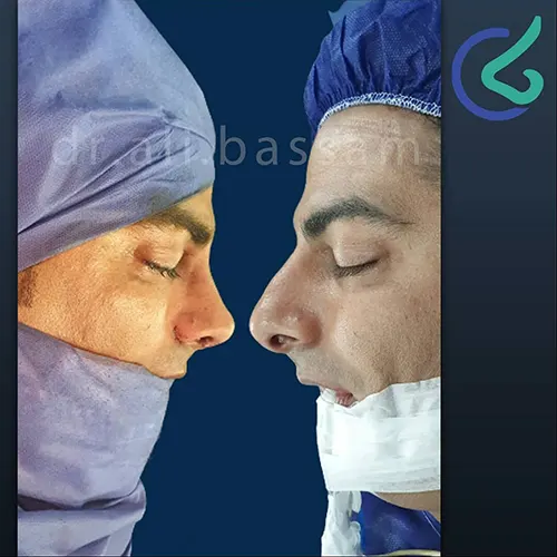 نمونه کار قبل و بعد عمل بینی