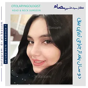 مدل-عمل-بینی-نیمه-فانتزی