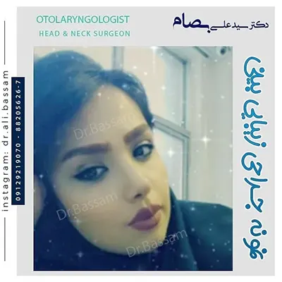 نمونه-کار-جراحی-بینی-فانتزی