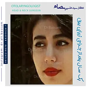 نمونه-کار-جراحی-بینی-نیمه-فانتزی