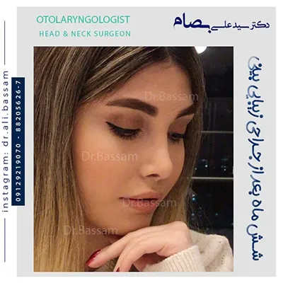 نمونه-کار-عمل-بینی-فانتزی-دخترانه