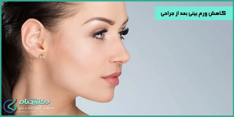 کاهش ورم بینی بعد از جراحی