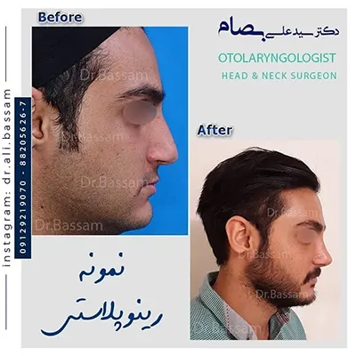 نیمه فانتزی آقایان