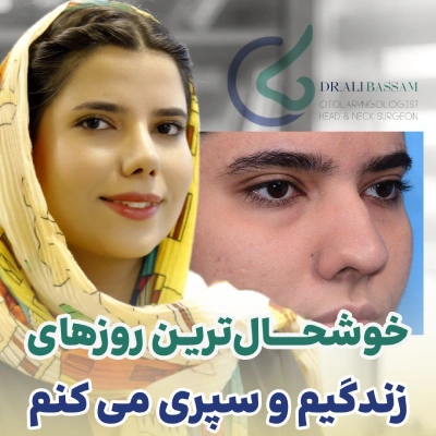 عمل قوز بینی