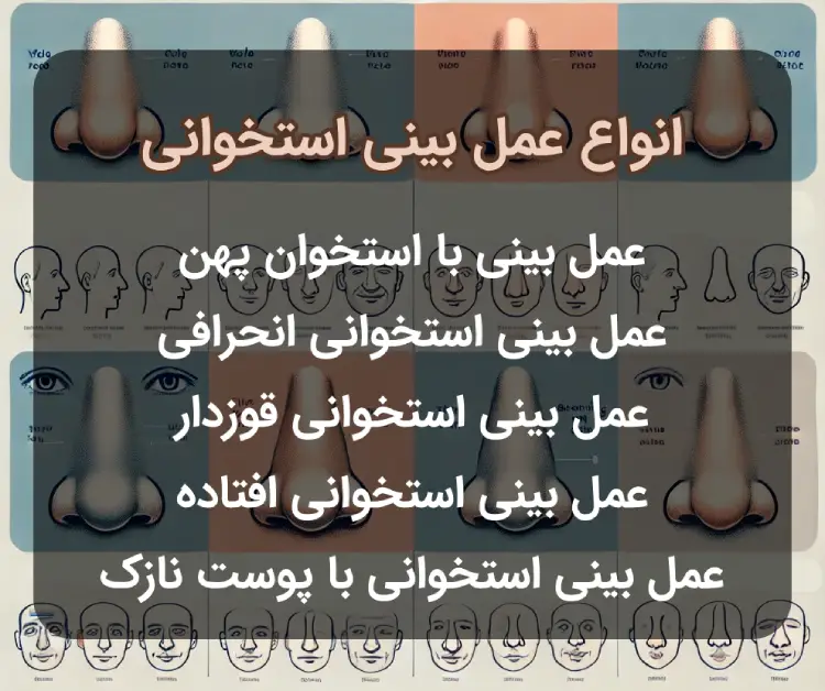 انواع بینی استخوانی