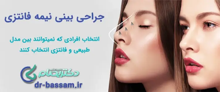 عمل بینی فانتزی