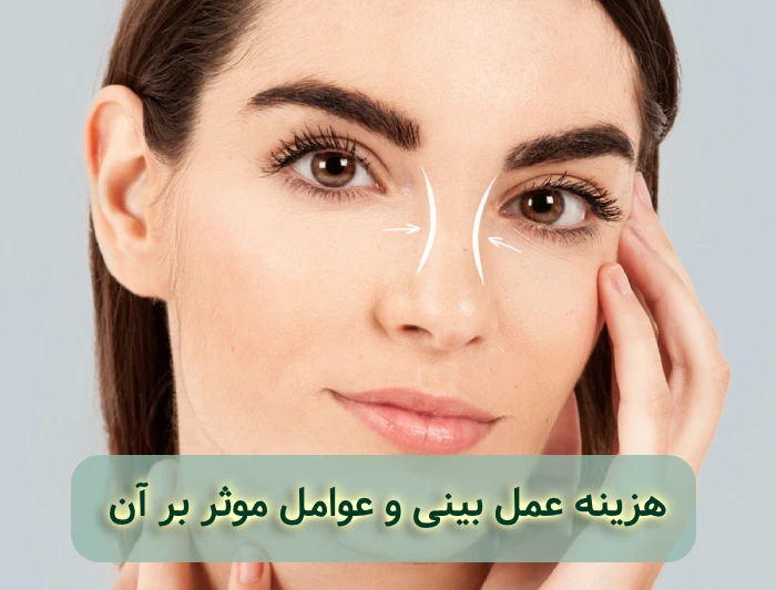 هزینه عمل بینی در تهران