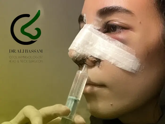 مراحل شستشوی بینی بعد از جراحی