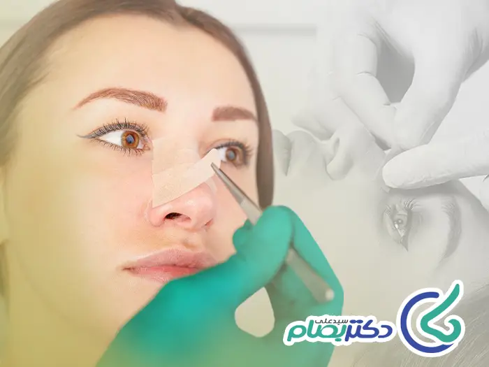 نحوه چسب زدن بعد عمل بینی