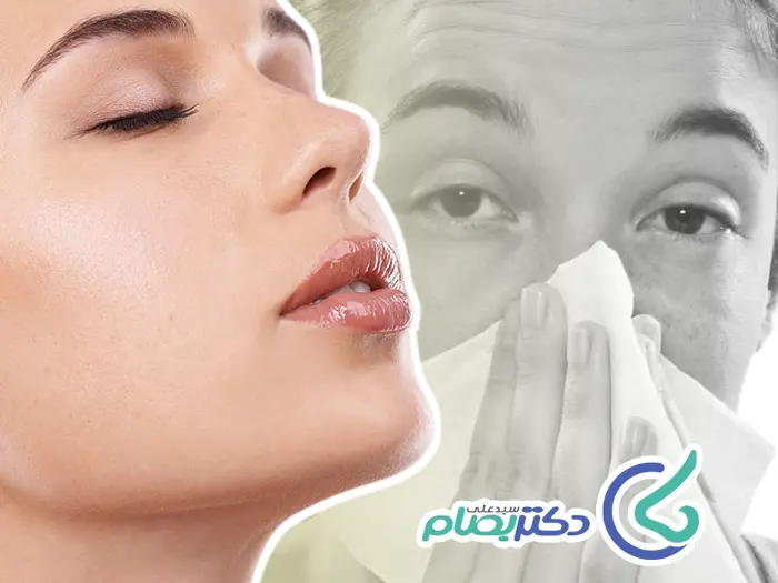 فین کردن بعد رینوپلاستی