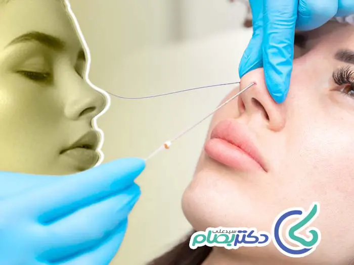 کوچک کردن بینی بدون جراحی