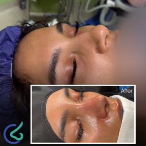 بهترین جراح بینی طبیعی