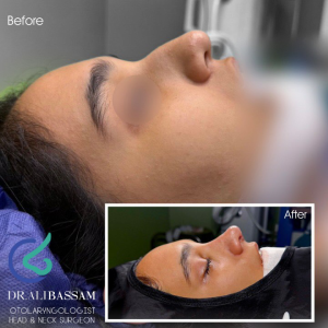 جراح عمل بینی طبیعی