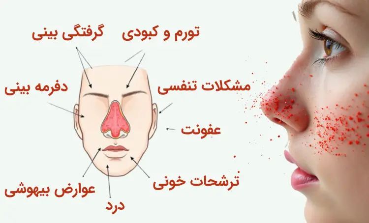 عوارض عمل جراحی بینی