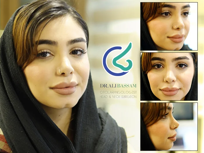 نظرات جراحی بینی