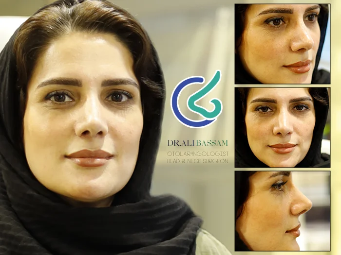 نظر جراحی بینی