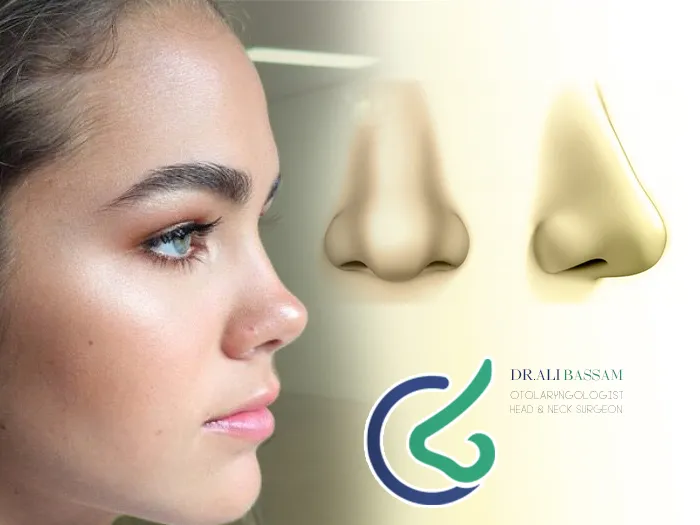 عمل بینی فرانسوی