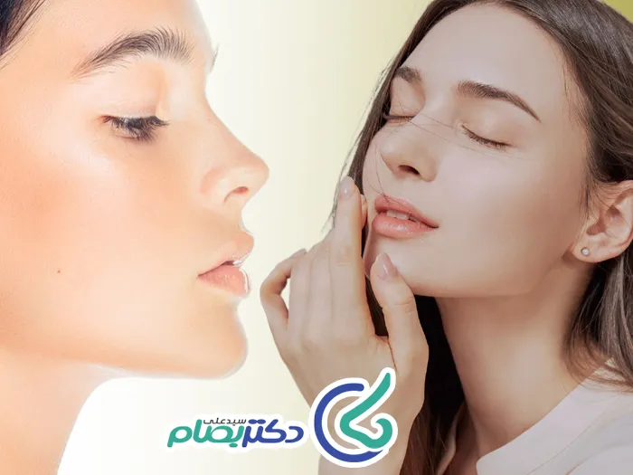 مدل بینی فرانسوی