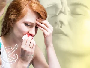 خون دماغ