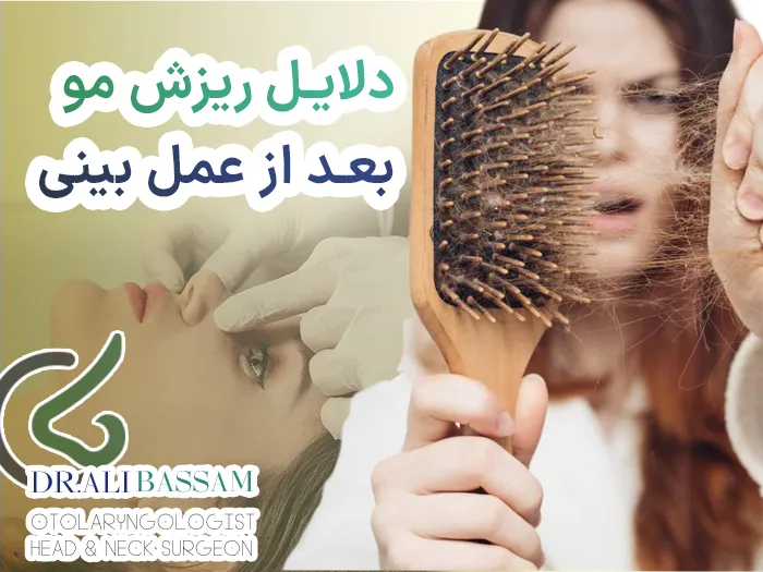 ریزش مو بعد از عمل بینی