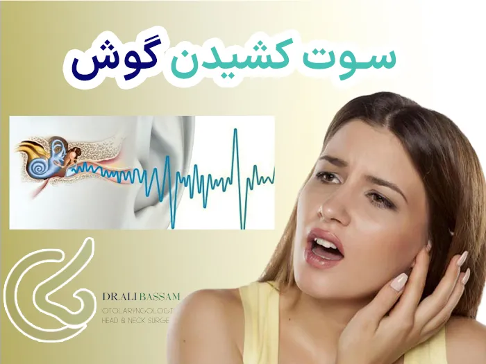 وزوز گوش