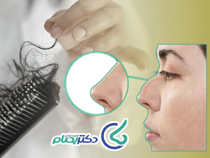 ریزش مو بعد عمل