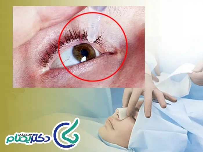 پماد بعد جراحی بینی