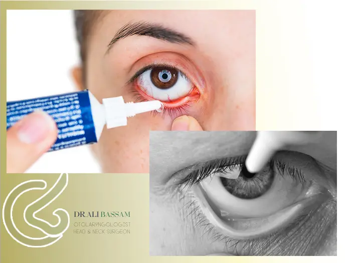 پماد روی چشم بعد عمل بینی