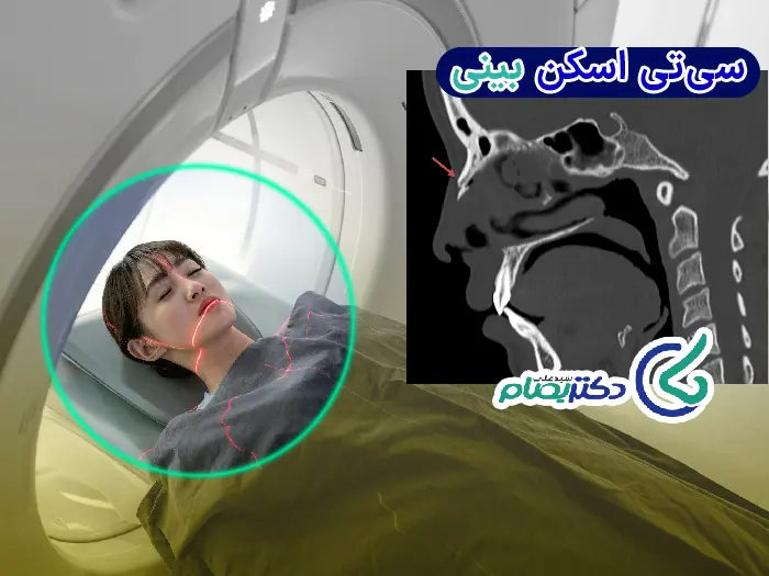اسکن بینی
