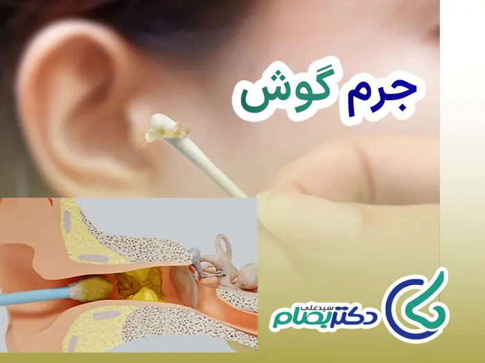 جرم گوش