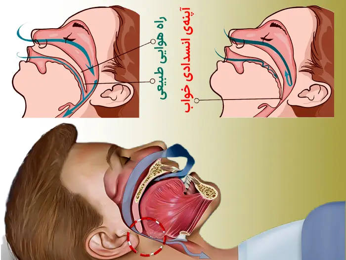 وقفه تنفسی