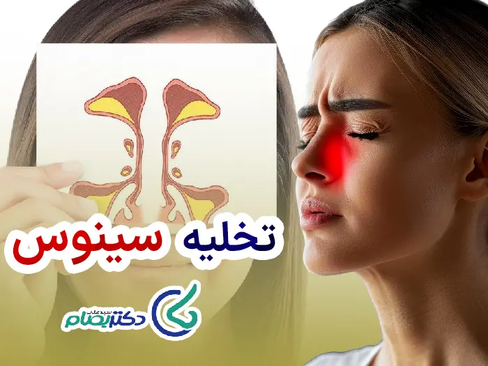 تخلیه سینوزیت