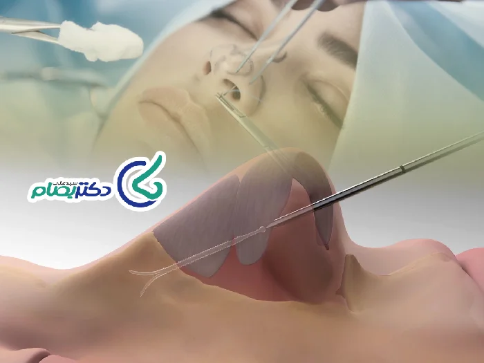 مشکل تنفسی بعد جراحی بینی