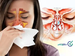 تخلیه سینوزیت