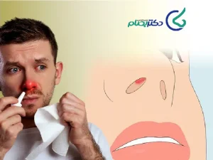 علت خارش نوک بینی