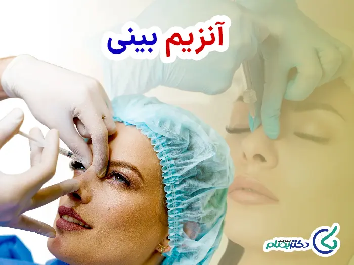 آنزیم به بینی