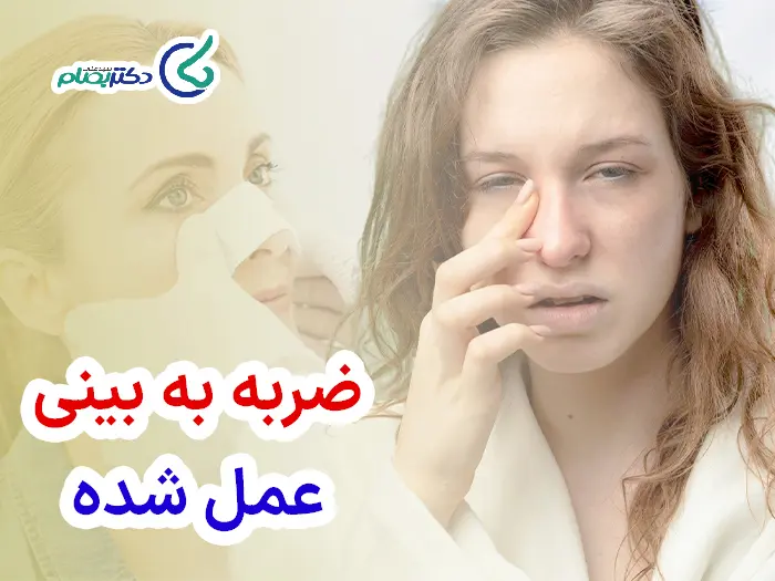 ضربه به بینی عمل شده