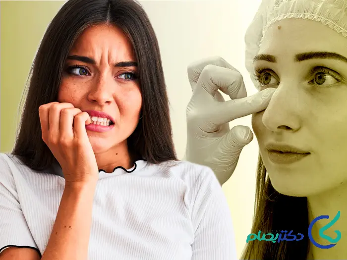 استرس از عمل بینی