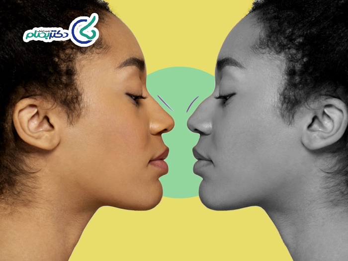 بهترین مدل برای عمل بینی کشیده