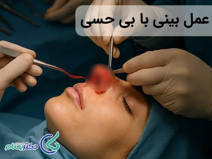 عمل بینی با بی حسی