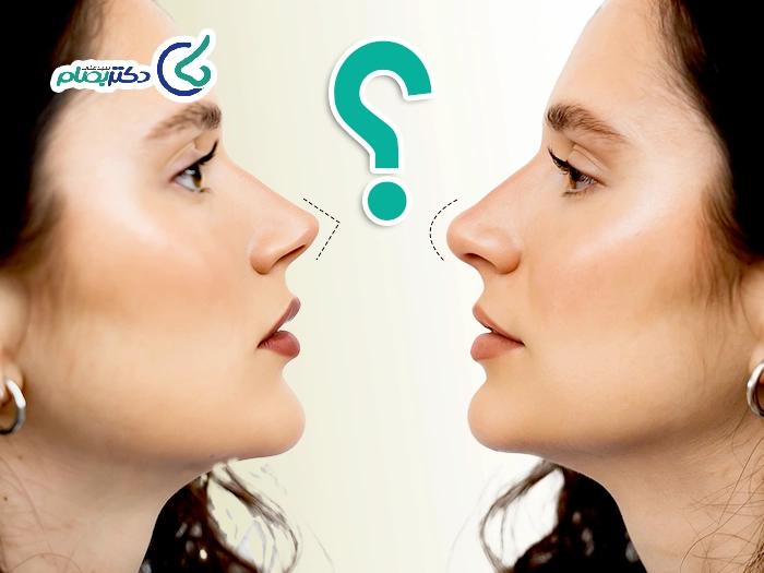 نوک تیز و گرد بینی