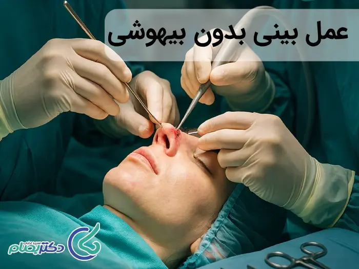 عمل بینی بدون بیهوشی